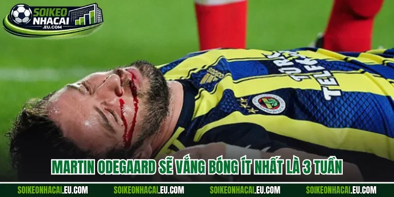 Martin Odegaard sẽ vắng bóng ít nhất là 3 tuần